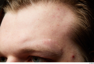 HD Face Skin Robert Watson eyebrow face forehead skin pores…
